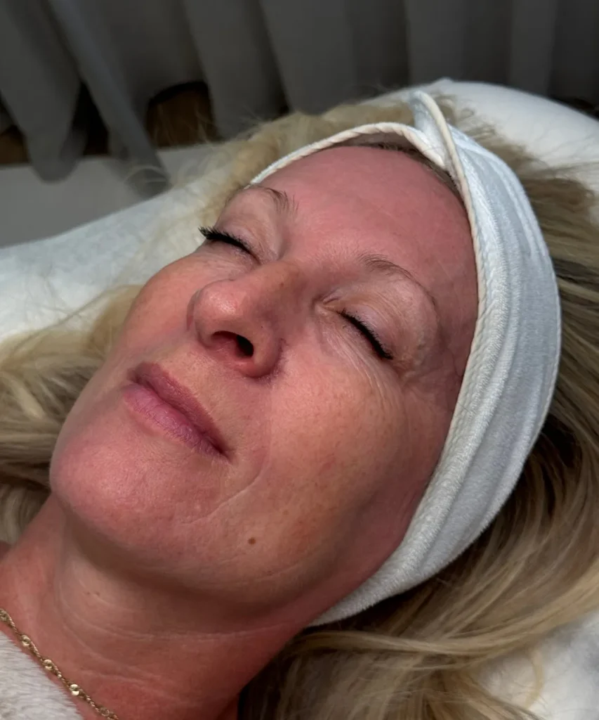 Understanding Neck & Décolletage Ageing | Selah Aesthetics in Fairfield, AU